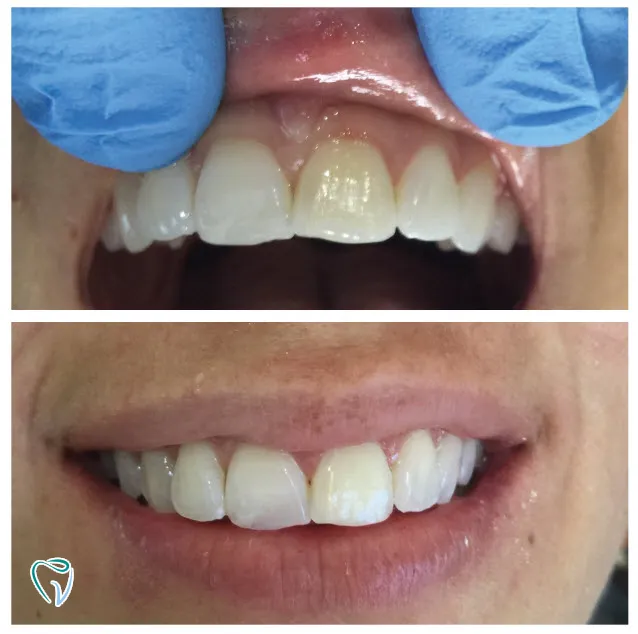 dental-10a