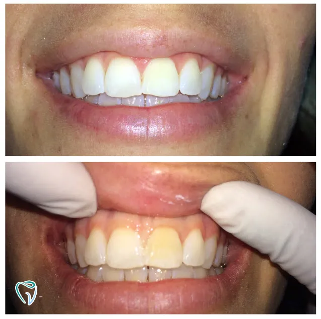dental-10b