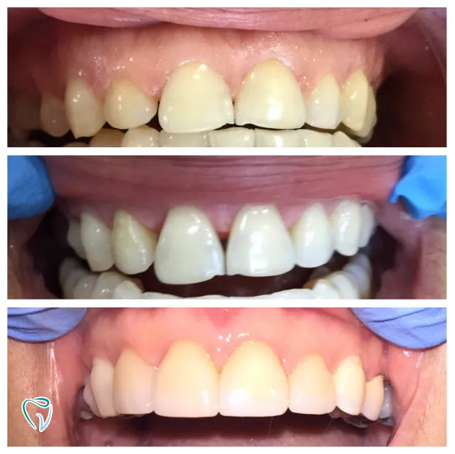 dental-1a