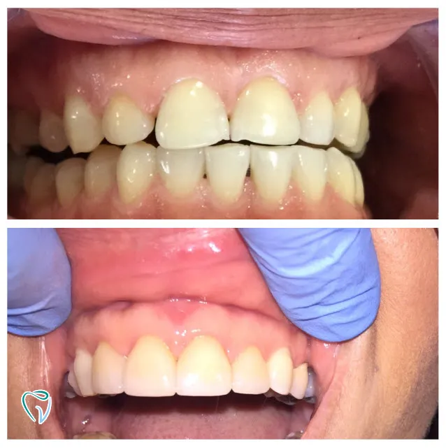 dental-1b