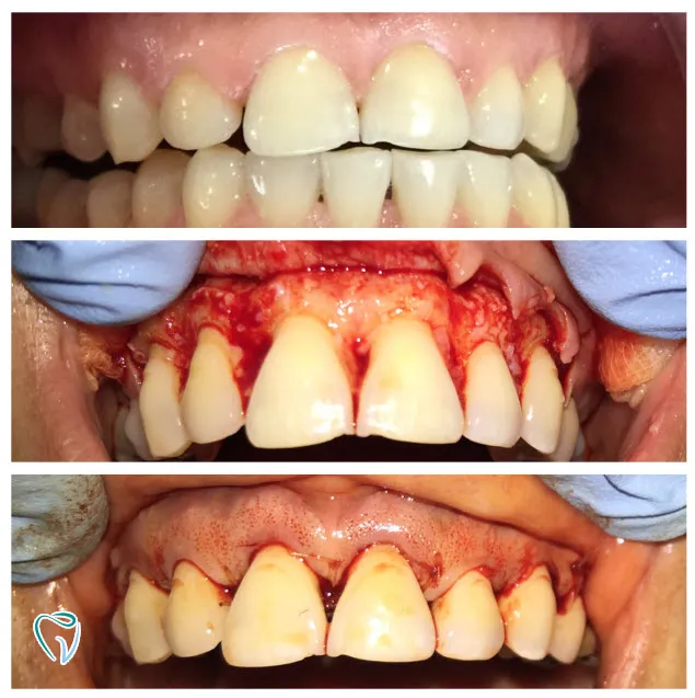 dental-1c