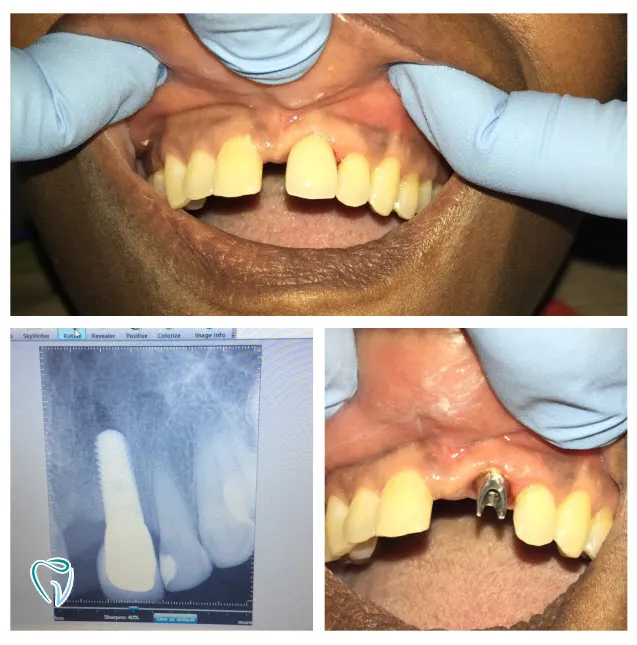 dental-2a