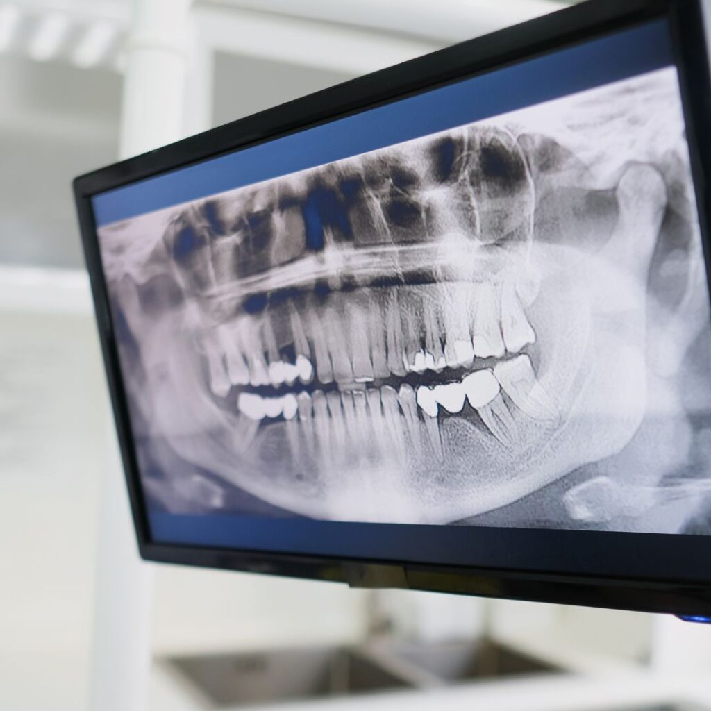 oral cancer screening 2
