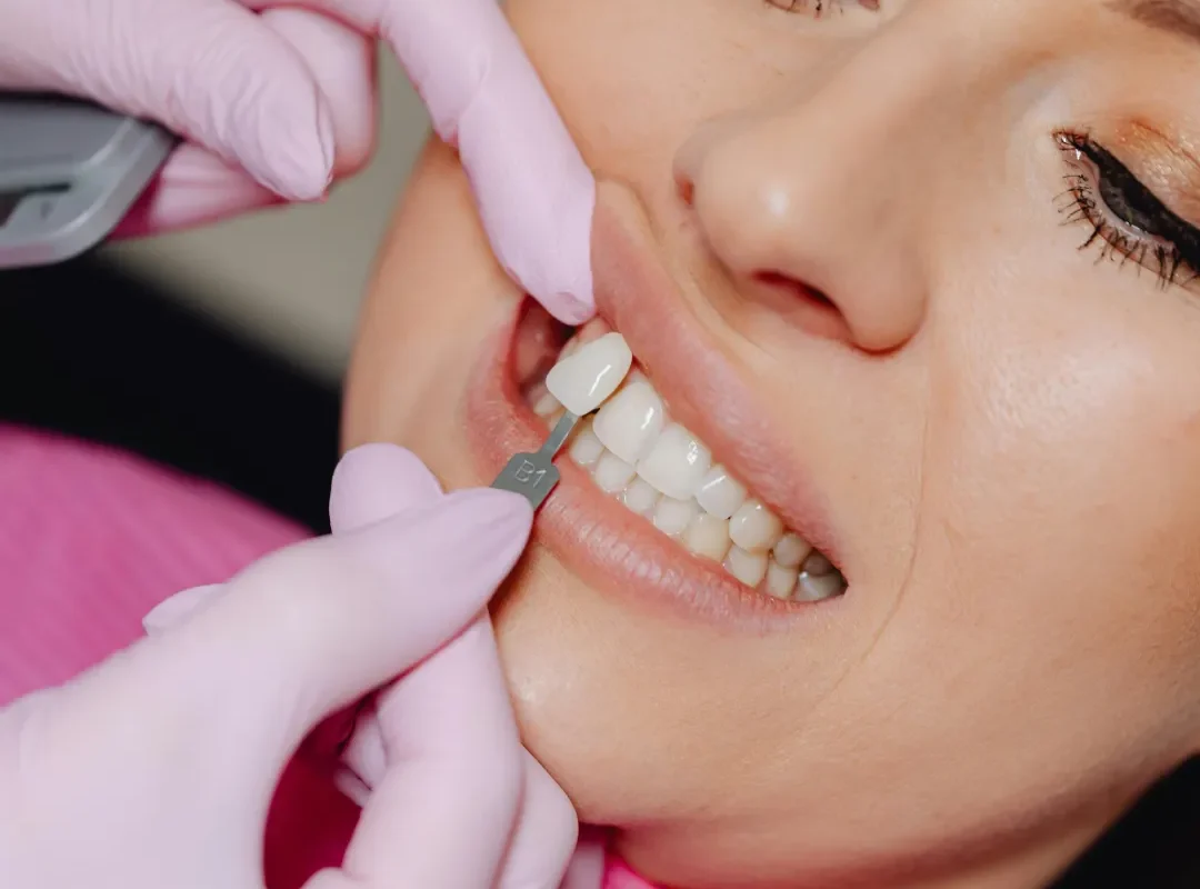cosmetic dentistry in barbados