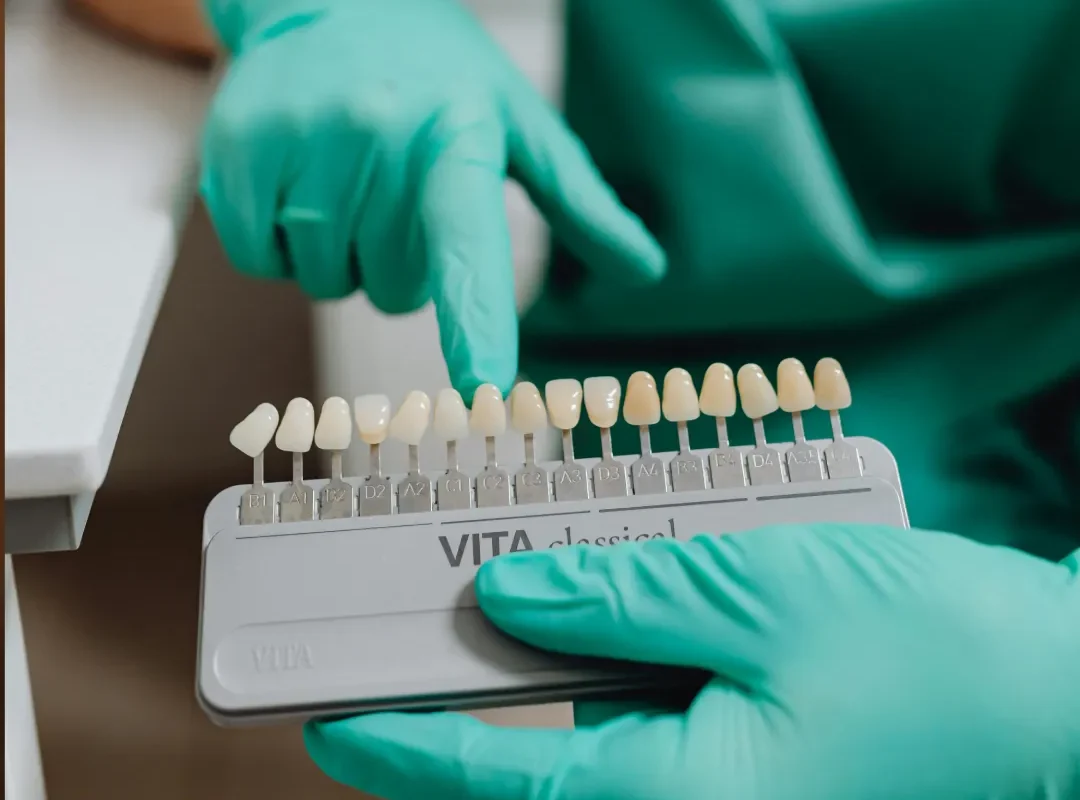 cosmetic dentistry veneers