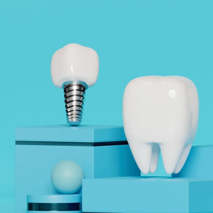 dental implants barbados